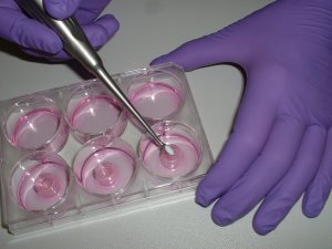 foto: MatTek In Vitro