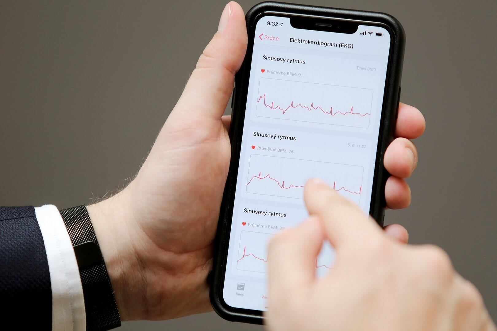 Apple EKG_Mezinárodní centrum pro telemedicínu