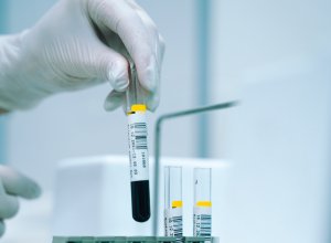 Foto Akram Huseyn / unsplash.com