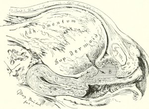 Ilustrace z knihy "Diseases of the kidneys, ureters and bladder, with special reference to the diseases of women" (1922)